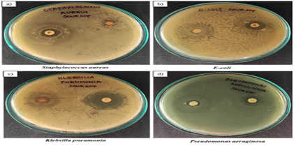 Evaluation of Secondary Metabolites in Soursop  (Annona muricata Lin.) Leaves and Fruits: A Comparative Analysis of Solvent Extracts