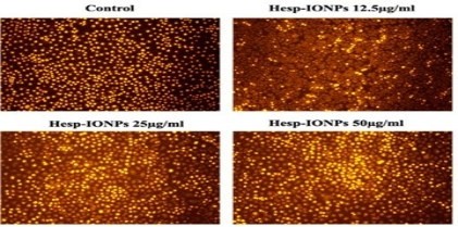 Preparation, Characterization and Evaluation of Antioxidant, Anti-Inflammatory and Anti-Cancer Properties of Hesperidin Conjugated Iron Oxide Nanoparticles